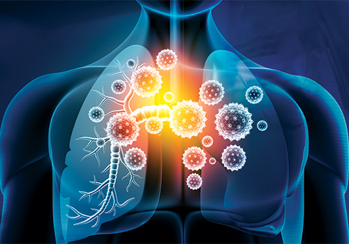 ΕΟΔΥ: Εβδομαδιαία Έκθεση Επιδημιολογικής Επιτήρησης Αναπνευστικών Λοιμώξεων Εβδομάδα 28/2024 (08 Ιουλίου 2024 – 14 Ιουλίου 2024)